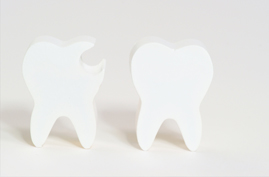 歯周病が、歯を失う要因第1位ってご存知ですか？