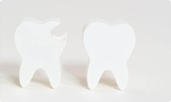 歯周病治療（歯石取り・歯茎の治療）